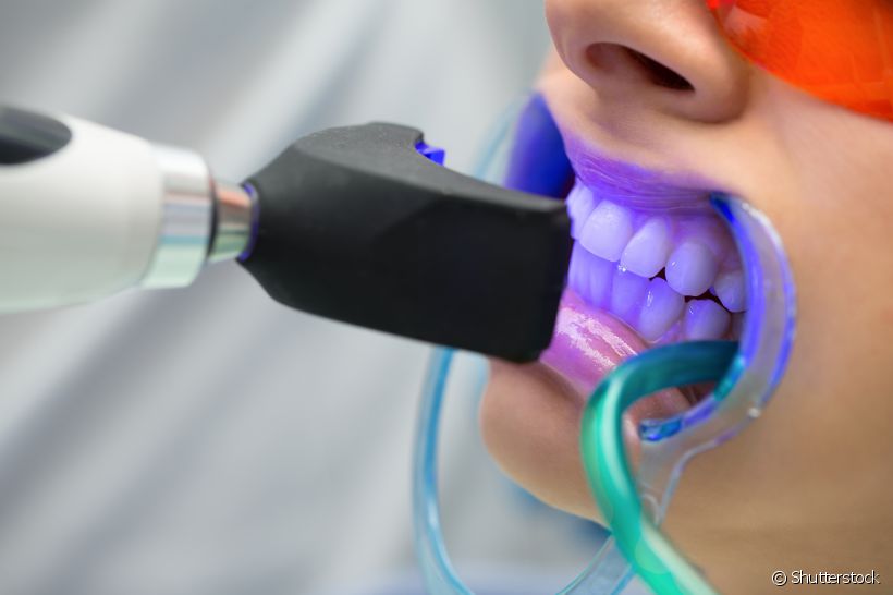Branqueamento pode acabar com o esmalte dentário?