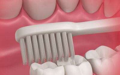 Dentista ensina a limpar o dente siso. Confira!