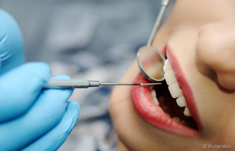 Sisos inclusos podem provocar cistos? Cirurgião-dentista explica