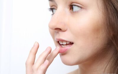 Herpes labial pode trazer problemas para a saúde bucal?