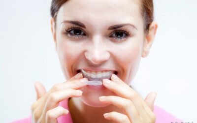 O que não deve ser feito no clareamento dental caseiro