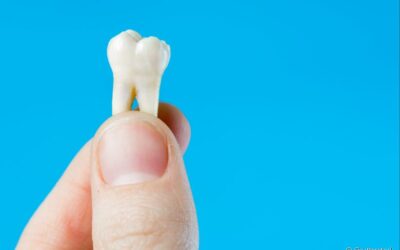 Entenda por que o dente pode quebrar sem você perceber