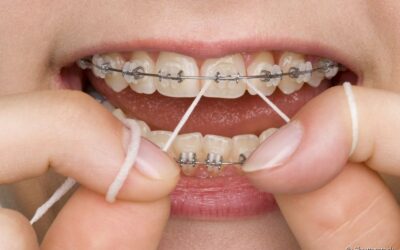 Dicas para escolher o melhor fio dental para o seu sorriso