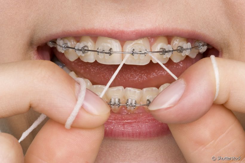 Dicas para escolher o melhor fio dental para o seu sorriso