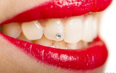 Entenda o que é piercing dental e quais devem ser os cuidados com esse acessório