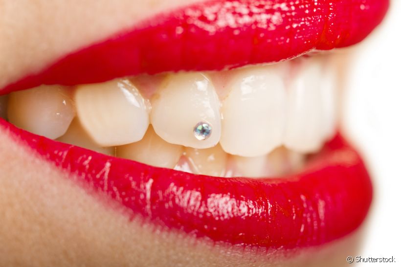 Entenda o que é piercing dental e quais devem ser os cuidados com esse acessório