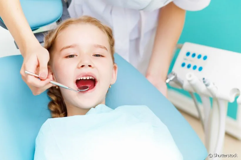 Aprenda a reconhecer os primeiros sinais de fluorose dentária Aprenda a reconhecer os primeiros sinais de fluorose dentária