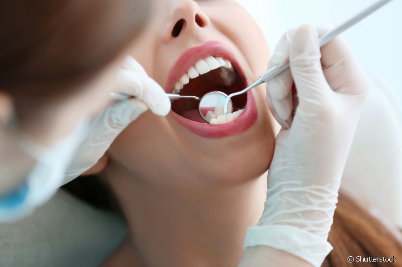 É possível não nascer nenhum dente siso na cavidade oral?