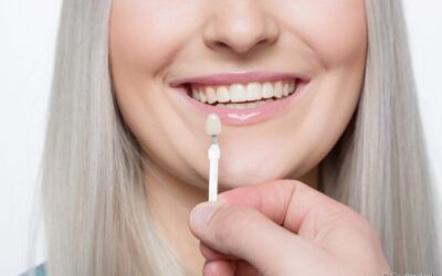 Existem restrições para a aplicação de lente de contato dental?