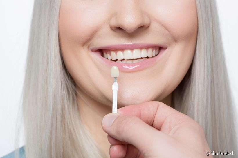 Existem restrições para a aplicação de lente de contato dental?