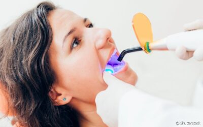 Fluorose pode desaparecer com o clareamento dental?