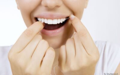 Como prevenir cárie entre os dentes por falta de fio dental