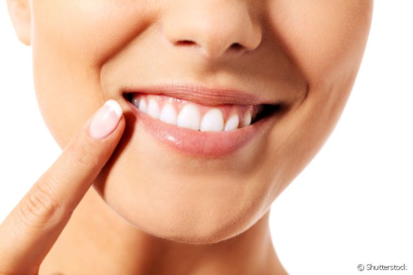 Como os dentes de serrinhas podem ser corrigidos? Dentista comenta o melhor procedimento para estes casos