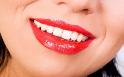 Coroa e raiz: conheça melhor essas partes dos dentes