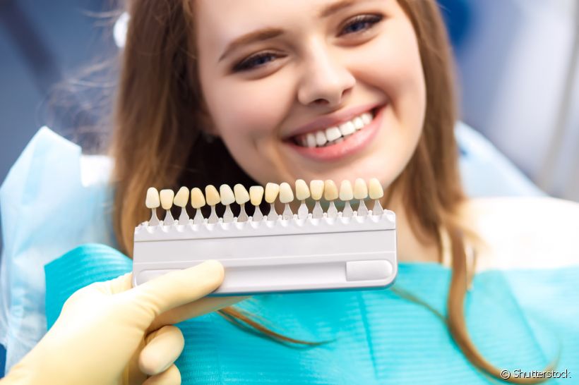 Mitos e verdades sobre a lente de contato dental