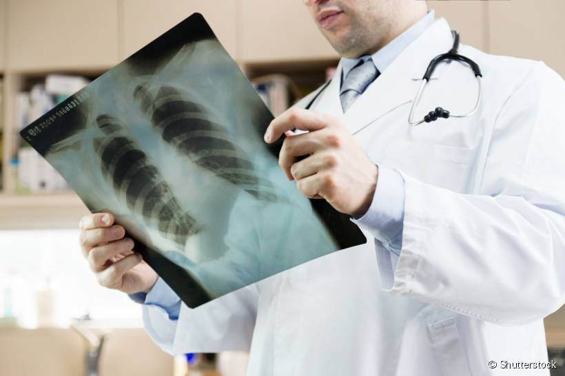Radiografias dentárias: uso, cuidados e benefícios