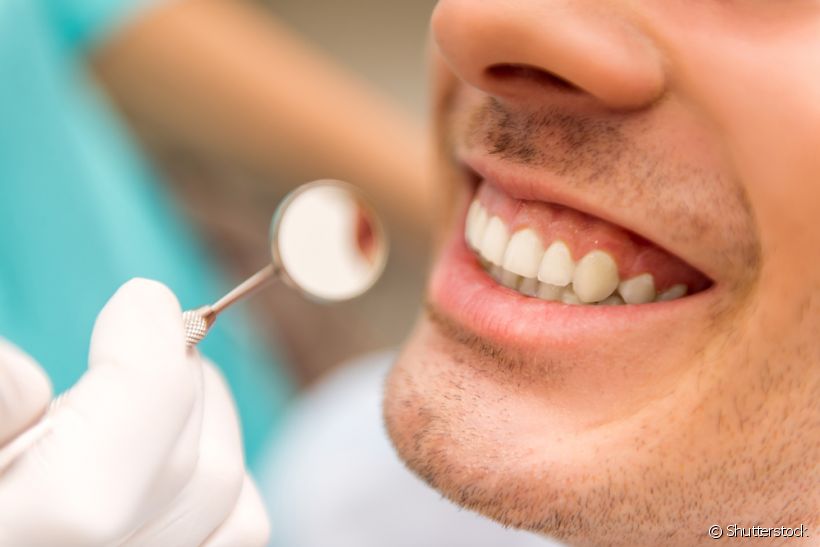 Pode fazer clareamento dental após o tratamento ortodôntico?