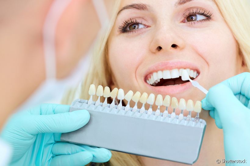 Lentes de contato dental: melhorias que vão além da estética