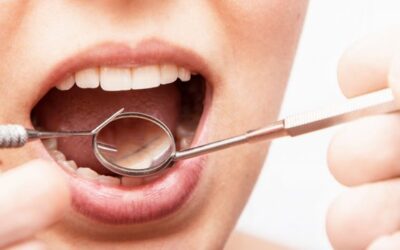 Abrasão e erosão dentária: quais os prejuízos para a saúde bucal?
