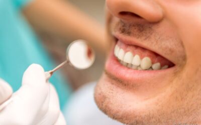 Entenda a diferença entre os dois tipos de manchas nos dentes