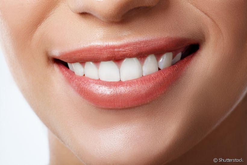 Saiba como manter os resultados do clareamento dental