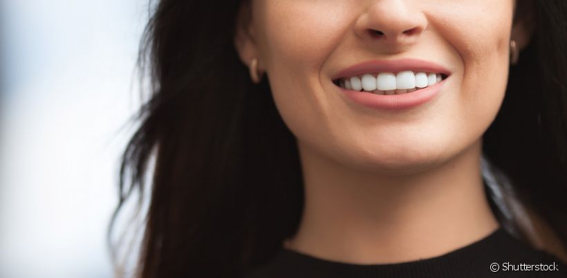 Mobilidade dental: o que pode estar acontecendo com seu dente?