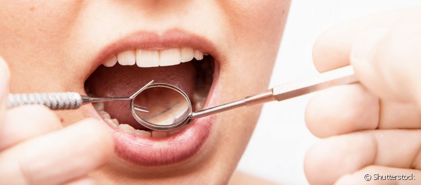 Dentista comenta em quais casos não é possível salvar um dente