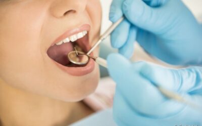 Veja quais hábitos devem ser evitados após a extração de dente