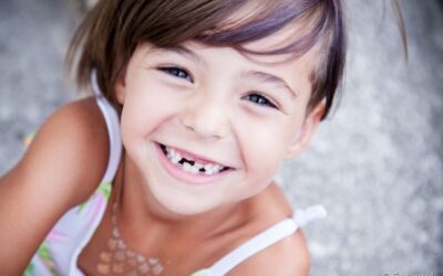Qual é a melhor hora para ensinar crianças a usar o fio dental?