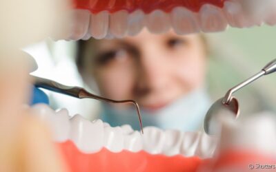 Restauração dentária: em que casos o procedimento é indicado?
