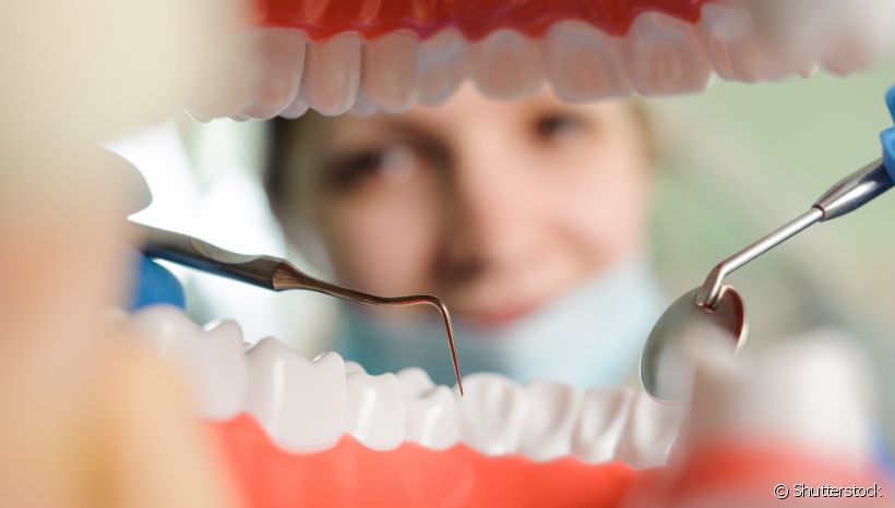 Restauração dentária: em que casos o procedimento é indicado?