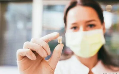 O que é, para quem é indicado e quais as vantagens do implante dentário?