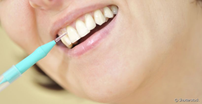 A escova interdental substitui o uso do fio dental?