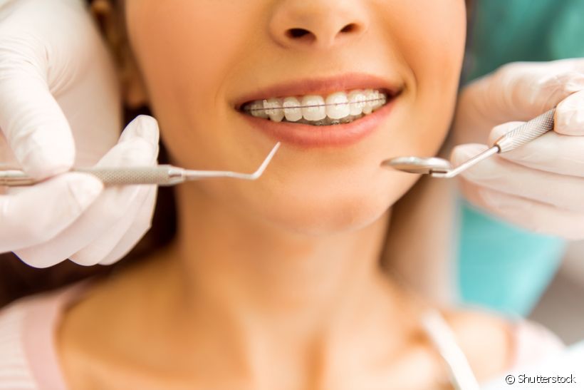 A manutenção do aparelho dentário é feita com que frequência?