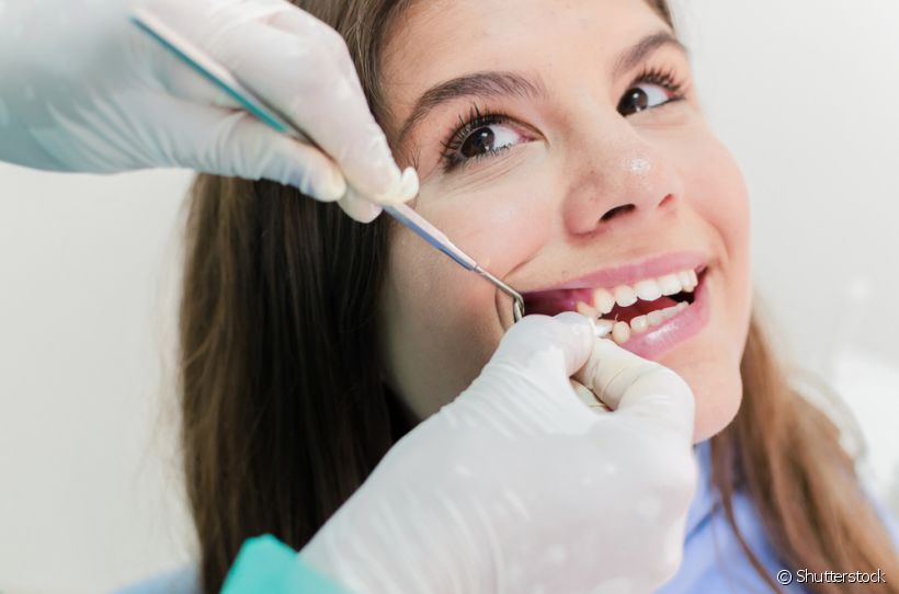 Reabsorção da raiz do dente: o que é e em quais casos acontece?