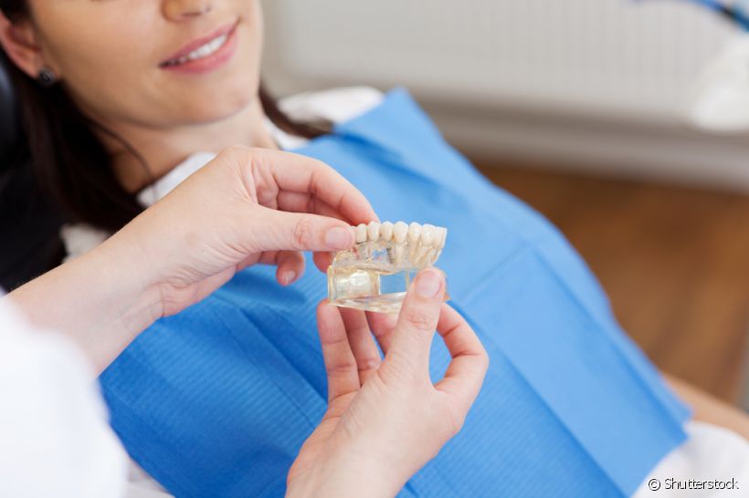 O implante dentário serve para implantar mais de um dente?
