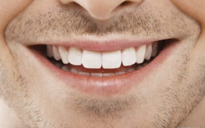 Qual é o tempo de recuperação de um implante dentário?