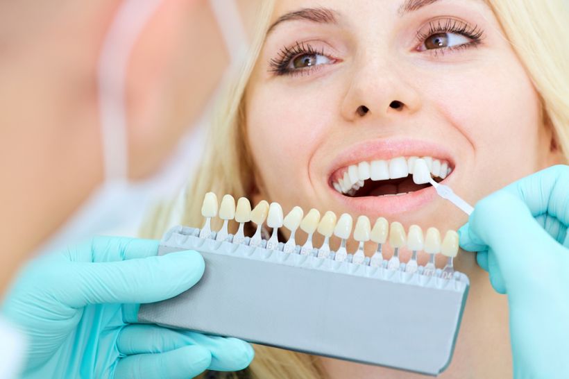 Prótese dentária moderna: uso da tecnologia para a saúde bucal