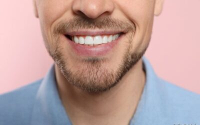 Dente da frente trincado: quais são os riscos? Existe tratamento?