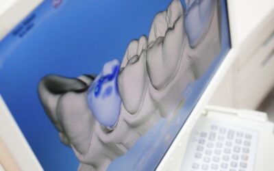 Odontologia 3D: conheça a tecnologia odontológica que consegue projetar os dentes pelo computador