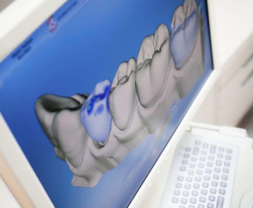 Odontologia 3D: conheça a tecnologia odontológica que consegue projetar os dentes pelo computador