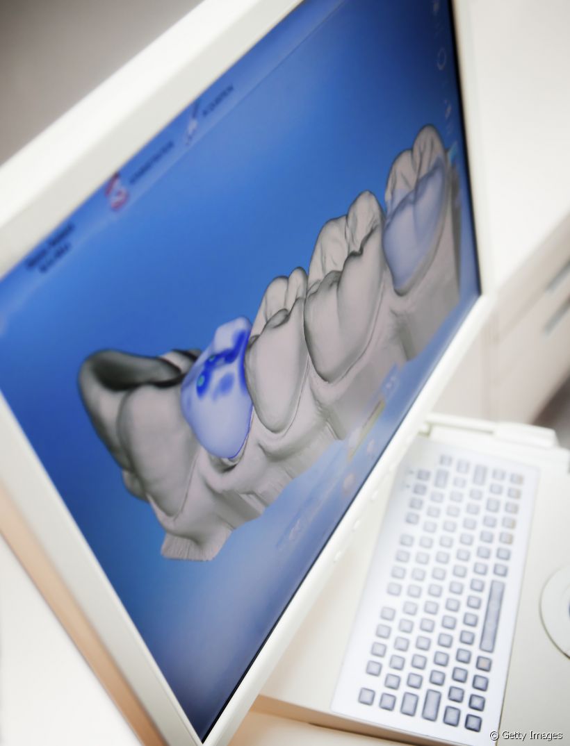 Odontologia 3D: conheça a tecnologia odontológica que consegue projetar os dentes pelo computador