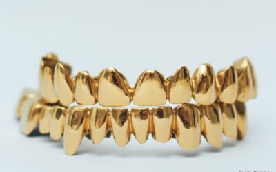 Dentes de ouro e diamante: entenda porque você não deve usar