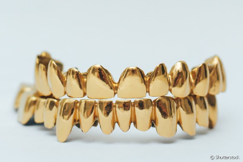 Dentes de ouro e diamante: entenda porque você não deve usar