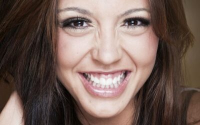 Quais as principais causas do sorriso gengival? Dentista explica os motivos por trás do desequilíbrio entre dentes e gengiva