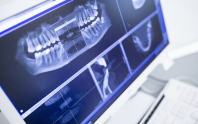 Ortodontia digital: veja como scanners, simuladores e outras ferramentas estão revolucionando tratamentos odontológicos