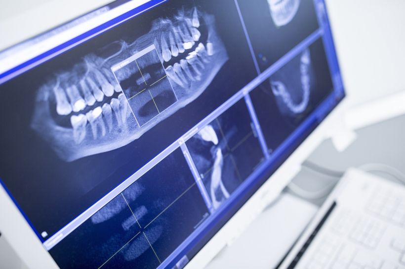 Ortodontia digital: veja como scanners, simuladores e outras ferramentas estão revolucionando tratamentos odontológicos