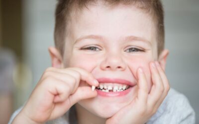 Confira 3 problemas que podem afetar os dentes de leite