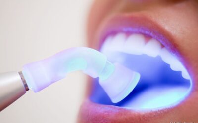 Tecnologia aliada à saúde: conheça os benefícios da combinação dos lasers Er:YAG e Nd:YAG para a odontologia