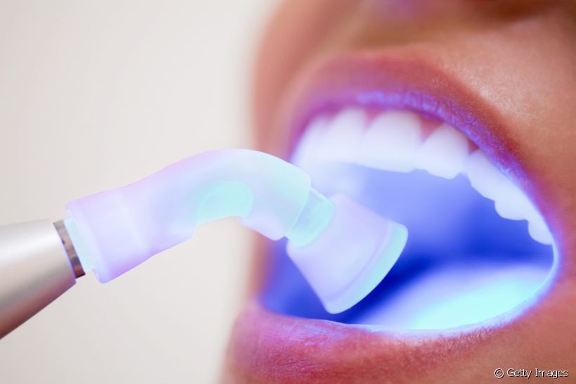 Tecnologia aliada à saúde: conheça os benefícios da combinação dos lasers Er:YAG e Nd:YAG para a odontologia